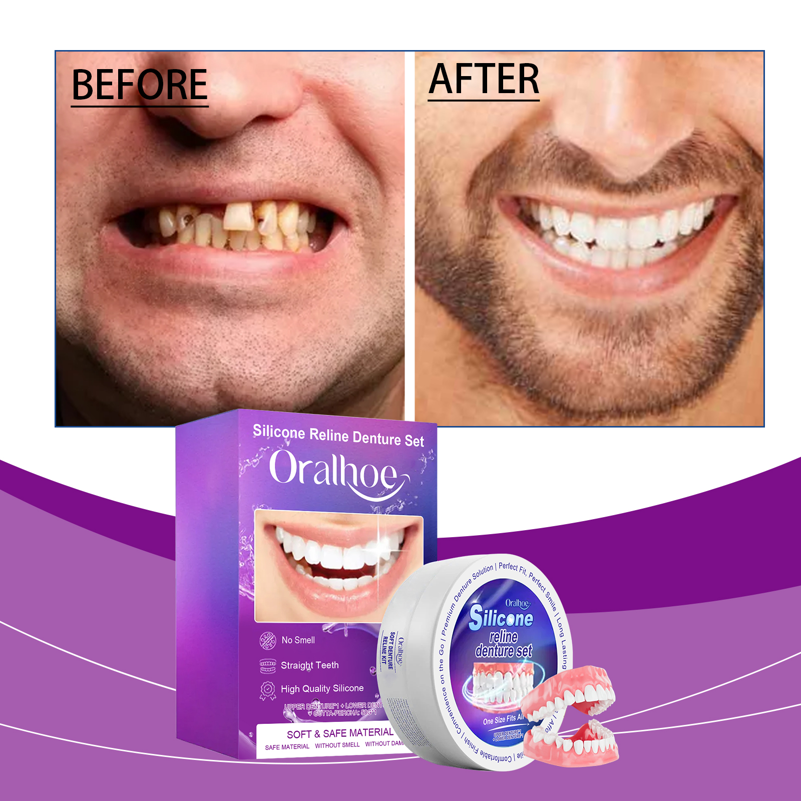 Dental Prosthesis Accessory Set - 1 Set Per Box photo 4